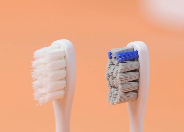 电动牙刷危害：经常不正确用电动牙刷的三大危害